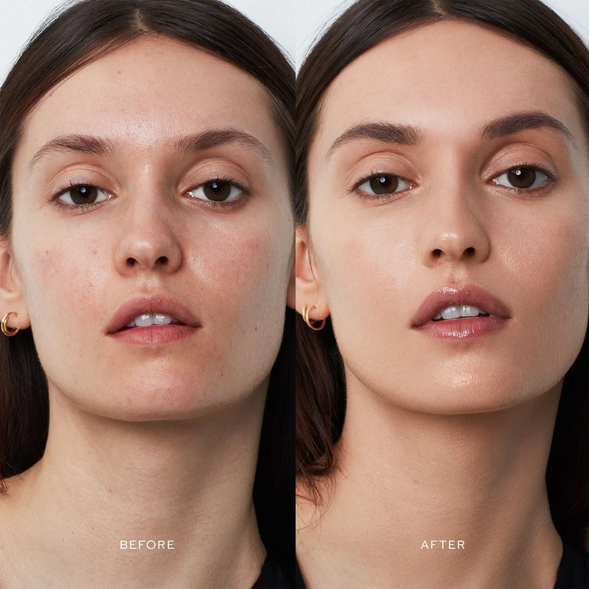 Vital Skincare Complexion Drops 17 Vital Skincare Complexion Drops - Image 15